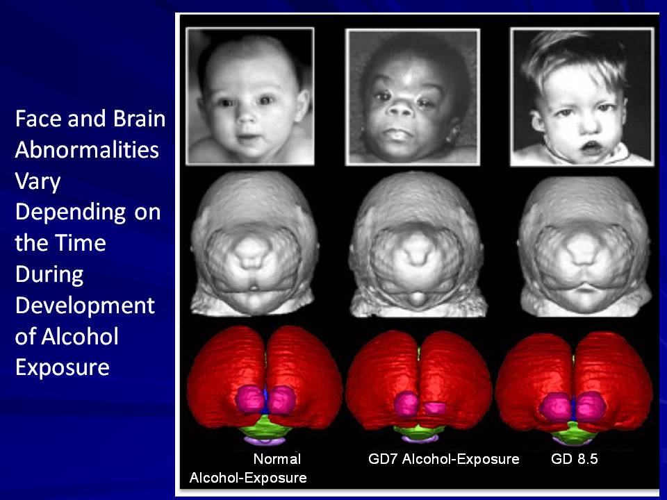 Effects Of Alcohol On Pregnant Women 111