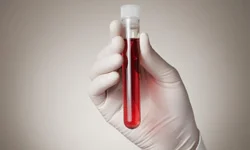 Blood Test
